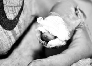 Cuarto quemado por pólvora en Ibagué