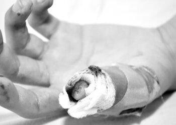 Ibagué suma siete lesionados por pólvora durante la celebración de Navidad