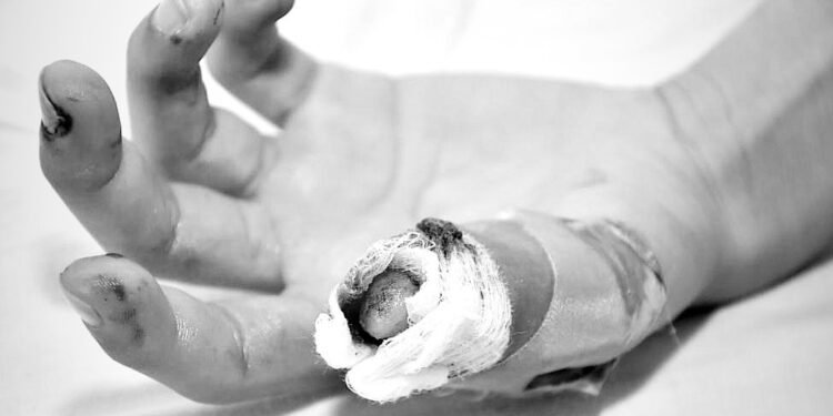 Ibagué suma siete lesionados por pólvora durante la celebración de Navidad