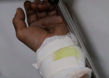 Evite tragedias: Celebre Navidad y Año Nuevo sin pólvora