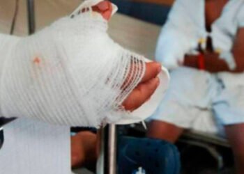 ¡Increíble! A un día de iniciar el mes de diciembre en Palocabildo ya se registraron dos personas quemadas con pólvora