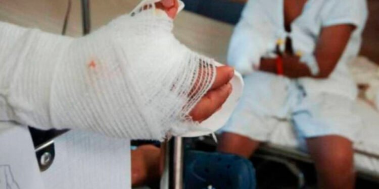 ¡Increíble! A un día de iniciar el mes de diciembre en Palocabildo ya se registraron dos personas quemadas con pólvora