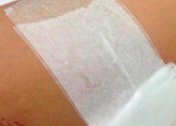 En medio de un requerimiento, uniformado de la policía fue herido con un arma blanca en uno de sus brazos