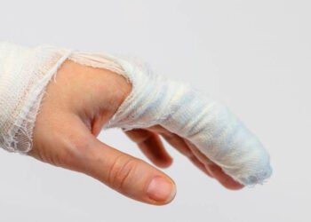 Cinco quemados por pólvora en la celebración de año nuevo de Ibagué 