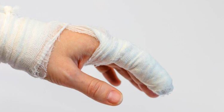 Cinco quemados por pólvora en la celebración de año nuevo de Ibagué 