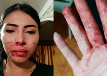 Joven Ibaguereña recibió brutal golpiza cuando salía con unos amigos en el sur de la capital del Tolima
