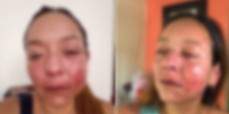 Jhonny Olmos cumpliría 42 meses de prisión por la brutal golpiza propinada a su expareja sentimental en Ibagué