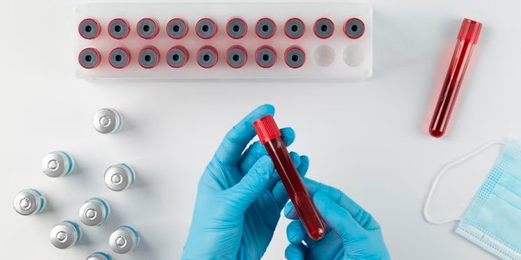 Autoridades de salud reportan tres casos letales por VIH en Ibagué