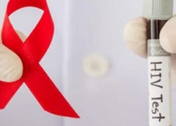 Cuidado con el VIH SIDA en estas fiestas