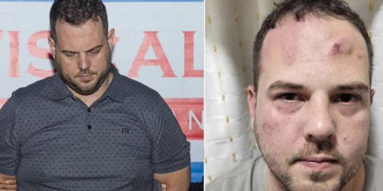 Presunta golpiza en la cárcel a John Poulos, el norteamericano capturado por el feminicidio de la DJ Valentina Trespalacios