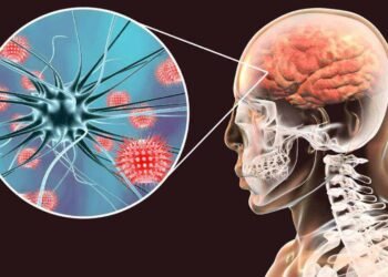 Anuncian posible brote de meningitis en el sur del Tolima