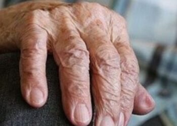 Abuelo fue víctima de los delincuentes que le robaron el dinero del Subsidio de Adulto Mayor