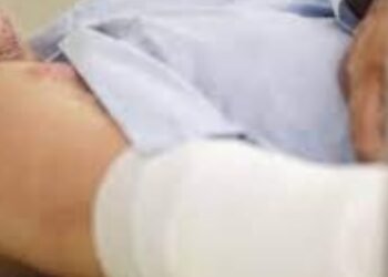 Ingresó un nuevo paciente a la unidad de quemados del Federico Lleras Acosta 