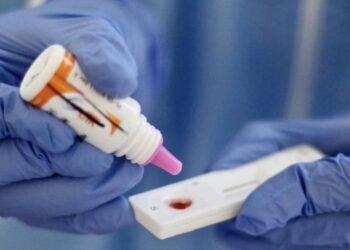 Nuevo caso de fallecimiento por VIH en Ibagué