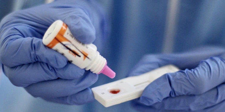 Nuevo caso de fallecimiento por VIH en Ibagué