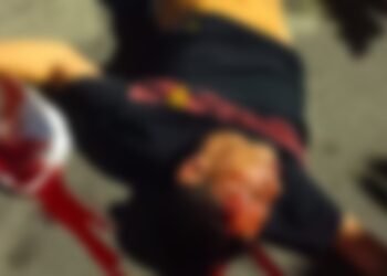 Fue identificado el hombre víctima de intento sicarial en Ibagué