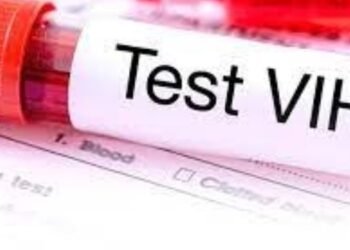 Lanzan jornada de “auto test VIH” para detectar casos tempranos