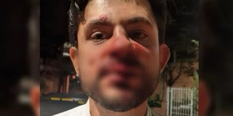 Periodista denuncia brutal agresión por parte de conductor de Uber debido a una empanada