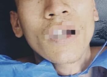 Sin ropa y desorientado, fue encontrado un joven en la vía Espinal – Chicoral