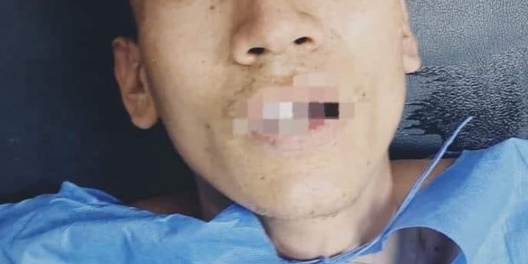 Sin ropa y desorientado, fue encontrado un joven en la vía Espinal – Chicoral