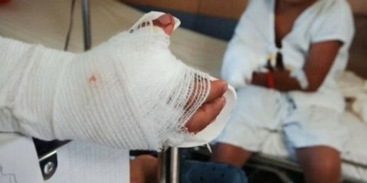 A 31 asciende la cifra de quemados en el Tolima