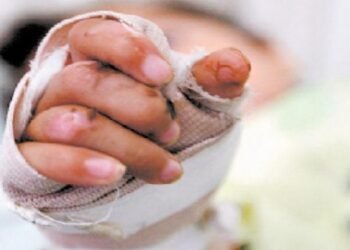 5 personas resultaron quemadas con pólvora en el Tolima durante la Noche de Velitas