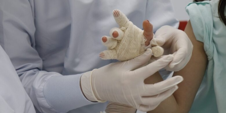 CrÍtico panorama en materia de quemados en Ibagué