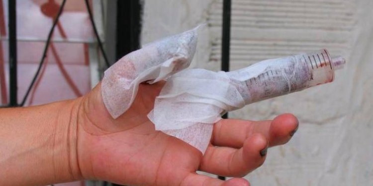 Cifras de quemados con pólvora en Colombia va en aumento