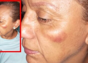 Indignante caso de violencia se registró en contra de una lideresa comunal de Ibagué