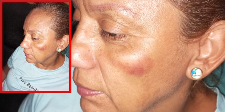 Indignante caso de violencia se registró en contra de una lideresa comunal de Ibagué