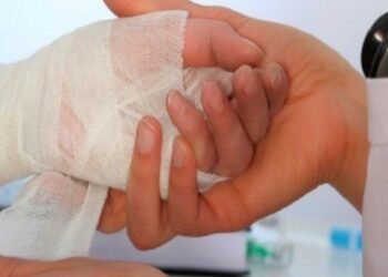 A ocho se eleva el número de quemados en Ibagué 