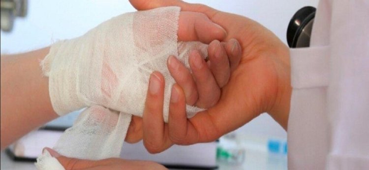 A ocho se eleva el número de quemados en Ibagué