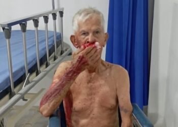 Abuelito fue arrollado y abandonado por motociclistas en El Guamo