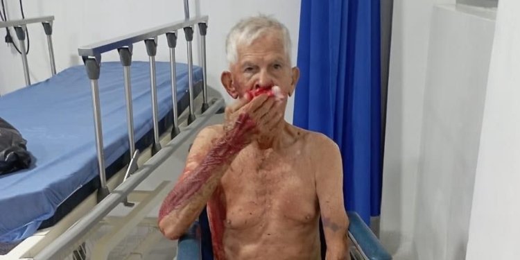 Abuelito fue arrollado y abandonado por motociclistas en El Guamo