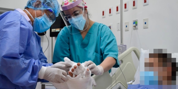 Siete personas resultaron quemadas el fin de semana de año nuevo