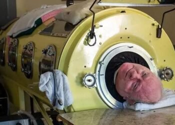 Muere a los 78 años Paul Alexander, conocido por su vida en un pulmón de acero