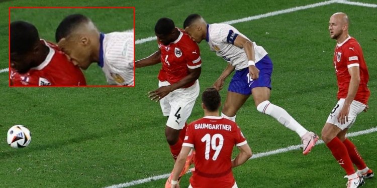 Terrible fractura de nariz sufrió Mbappé en la Eurocopa 2024