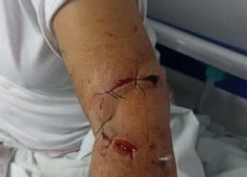 Comandante de la Metib aclaró que agresión que recibió líder del barrio Tierra Grata obedeció a temas personales