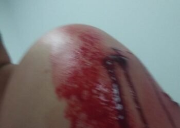 Taxista herido en medio de un atraco en la glorieta del Aeropuerto