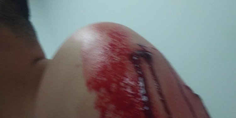 Taxista herido en medio de un atraco en la glorieta del Aeropuerto