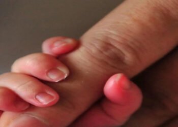 Joven en Barranquilla intenta quitarle la vida a su bebé recién nacido tras morderlo