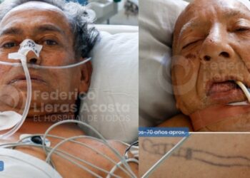 Dos hombres están sin identificar y en la UCI del Hospital Federico Lleras Acosta