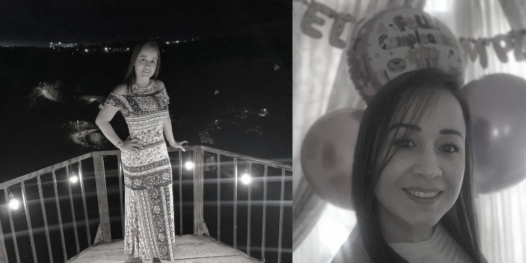 Falleció mujer por quemaduras que sufrió en un accidente casero