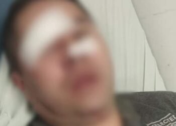 Taxista resultó herido en el rostro en medio de un intento de atraco