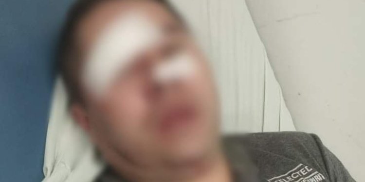 Taxista resultó herido en el rostro en medio de un intento de atraco