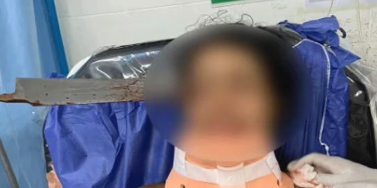 Horror en Córdoba: Adolescente de 14 años sobrevive tras cuchillo incrustado en la sien durante violenta pelea