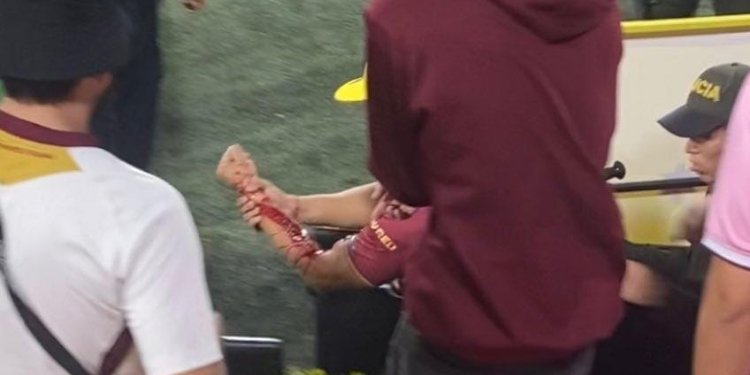 Hincha del Deportes Tolima resultó herido por fanático, al parecer, del Cali, que se sentó en la tribuna