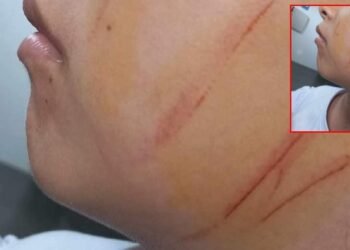 Por agresión a niña en el colegio Fe y Alegría de Nazaret, se pronunció la Secretaría de Educación