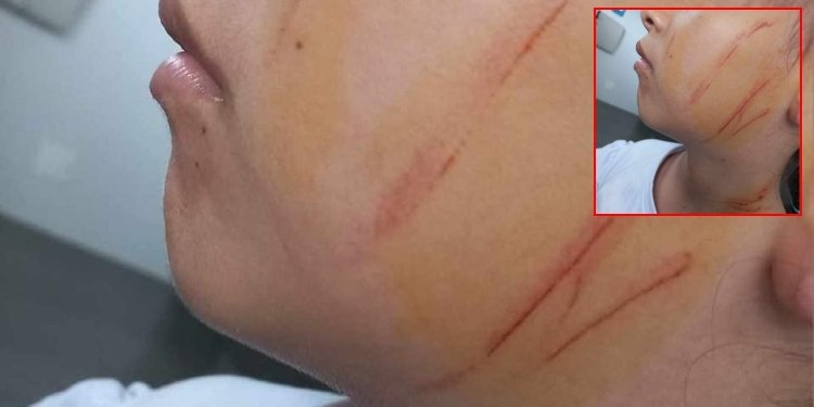 Por agresión a niña en el colegio Fe y Alegría de Nazaret, se pronunció la Secretaría de Educación