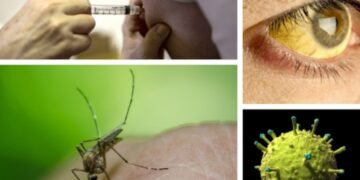 Reportar un caso de contagio por fiebre amarilla en Villarrica 